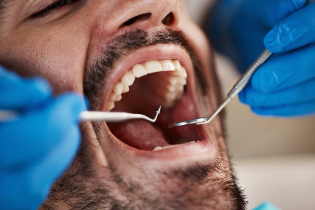 Best Pediatric Emergency Dentist in Lake Holiday, IN