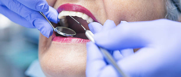 Best Emergency Tooth Extraction in Lake Holiday, IN